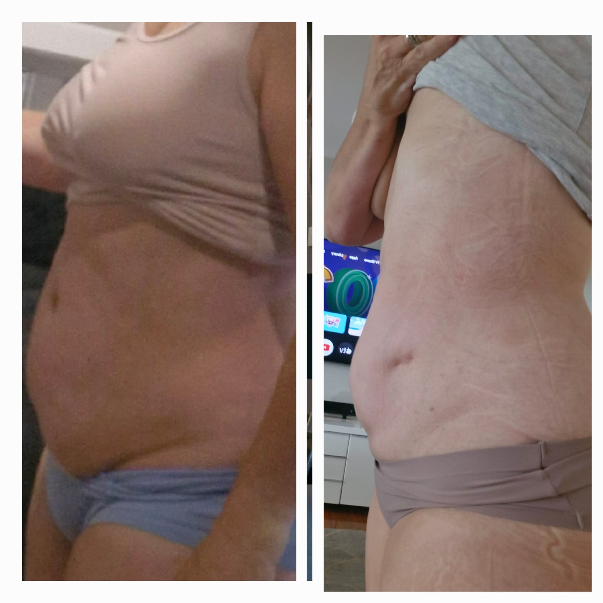Silvana Richards Weight Loss Reset transformation