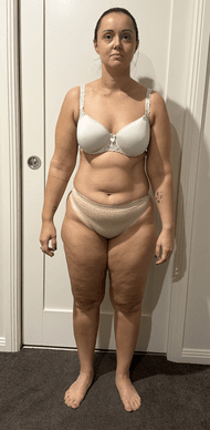 Stacey before Weight Loss Reset