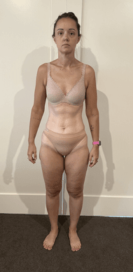 Stacey after Weight Loss Reset — 20kg down
