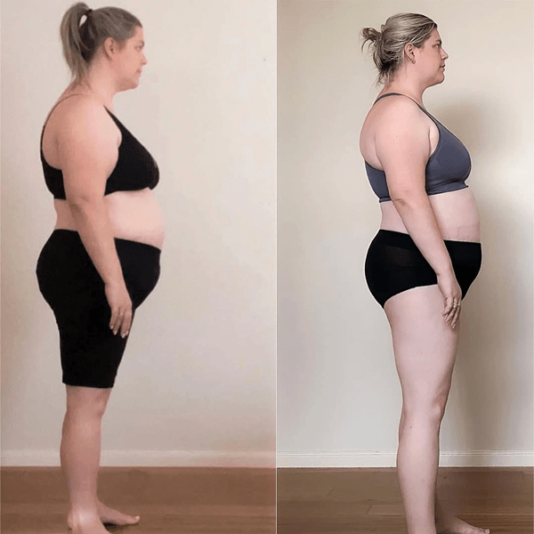 Alyandra before and after