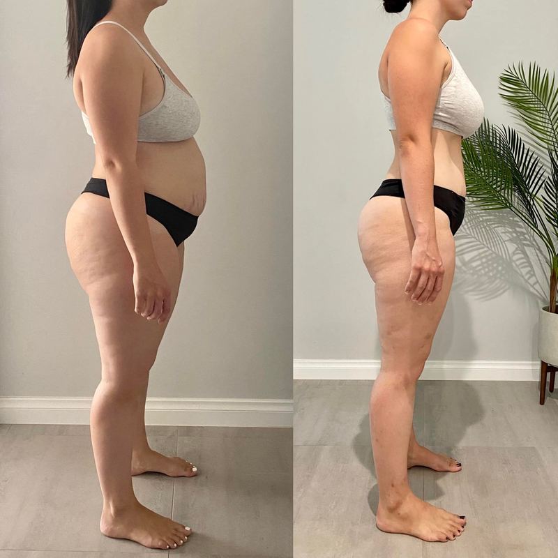 Weight Loss Reset before and after